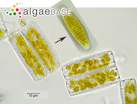 Diatoma vulgaris Bory