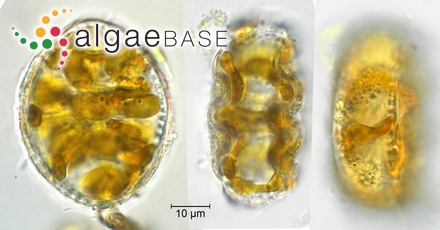 Cymatopleura elliptica (Brébisson) W.Smith