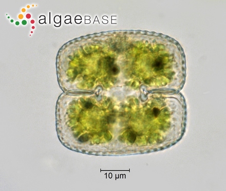 Cosmarium biretum subsp. trigibberum Nordstedt