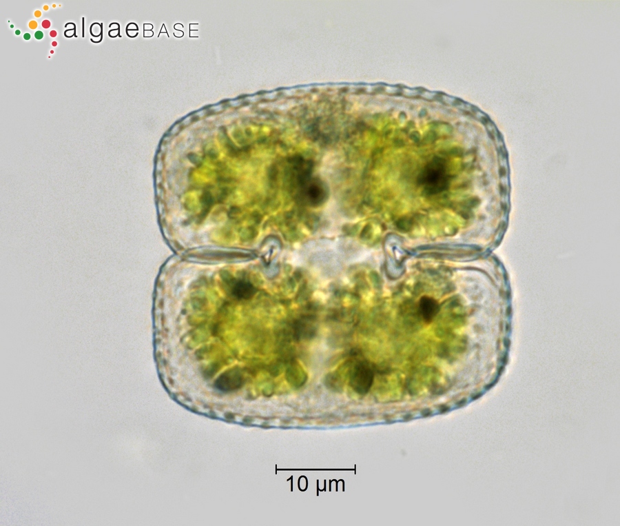 Cosmarium biretum subsp. trigibberum Nordstedt