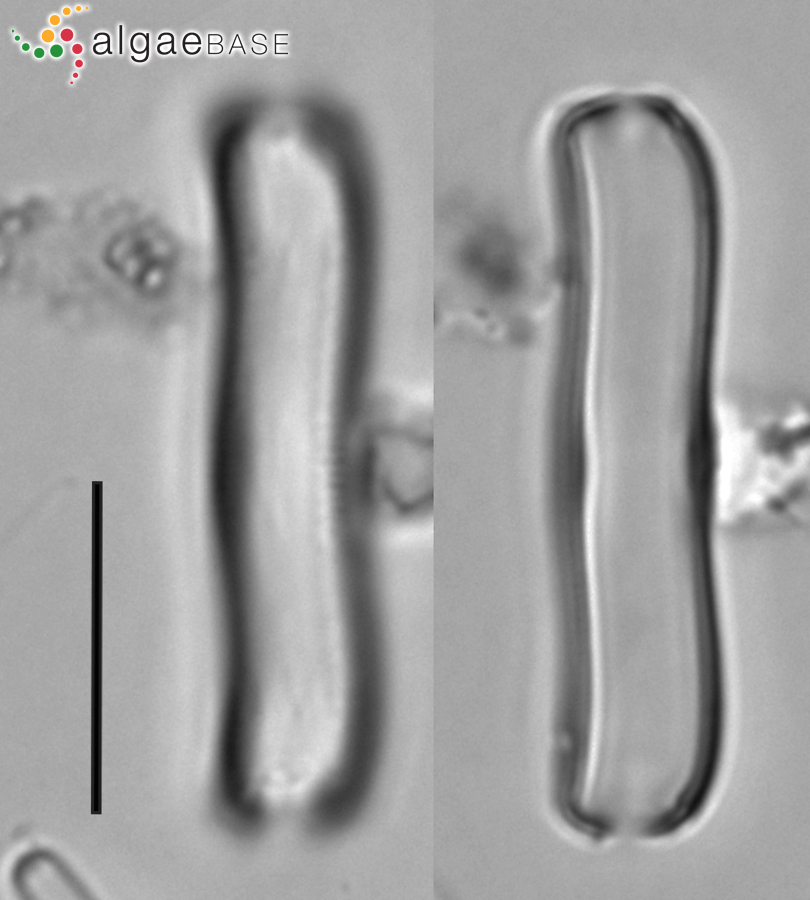 Achnanthidium trinode Ralfs