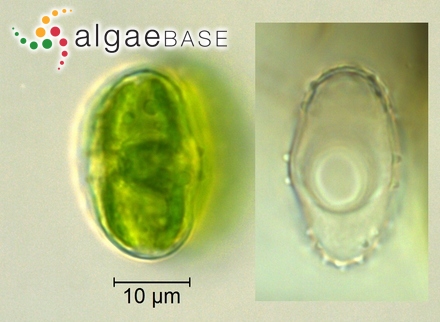 Chaetoceros muelleri Lemmermann