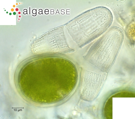 Penium margaritaceum Brébisson ex Ralfs
