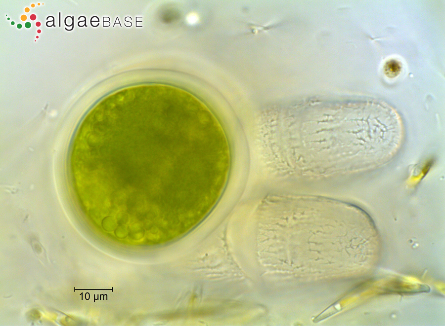 Penium margaritaceum Brébisson ex Ralfs