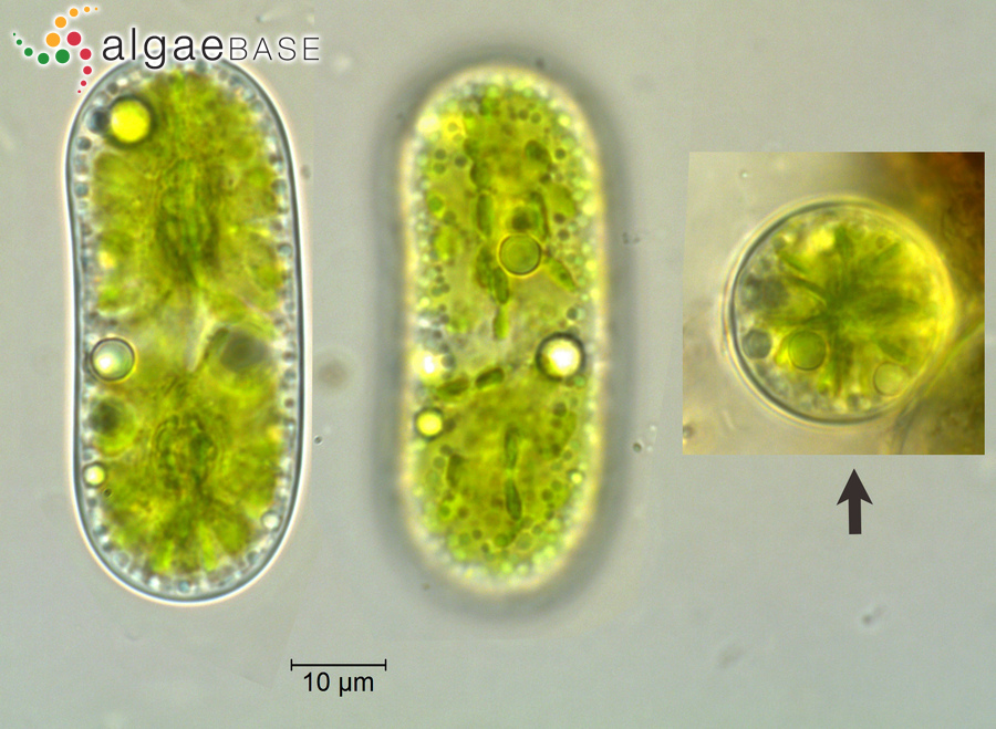 Cylindrocystis brebissonii (Ralfs) De Bary