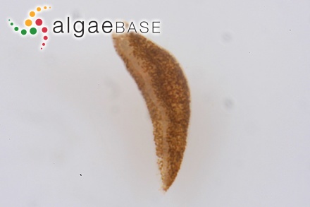 Licmophora hyalina (Kützing) Grunow
