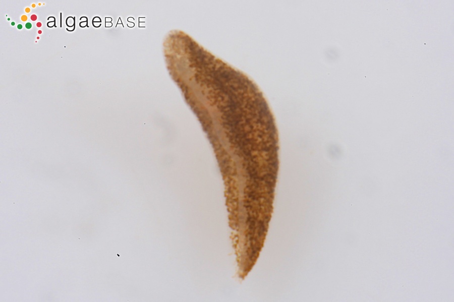 Licmophora hyalina (Kützing) Grunow