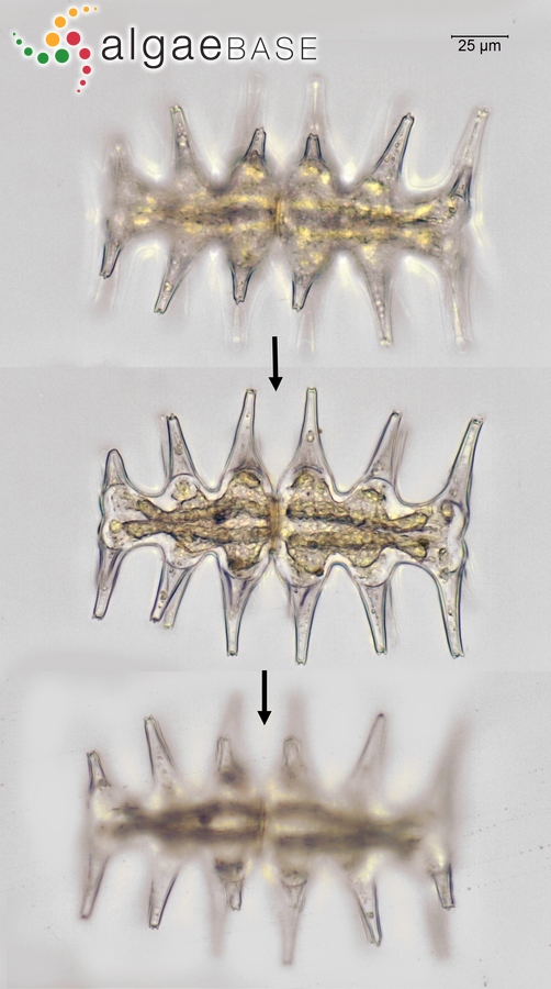 Micrasterias muricata Ralfs