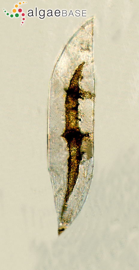 Neocalyptrella robusta (G.Norman ex Ralfs) Hernández-Becerril & Meave