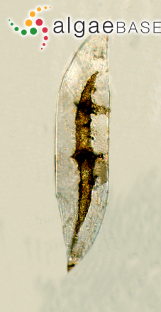 Neocalyptrella robusta (G.Norman ex Ralfs) Hernández-Becerril & Meave