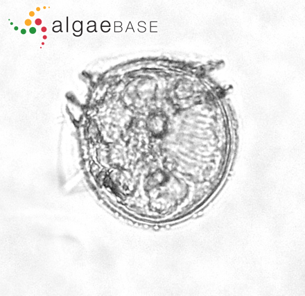 Phalacroma rotundatum (Claparéde & Lachmann) Kofoid & J.R.Michener