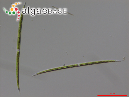 Closterium limneticum var. fallax Růžička