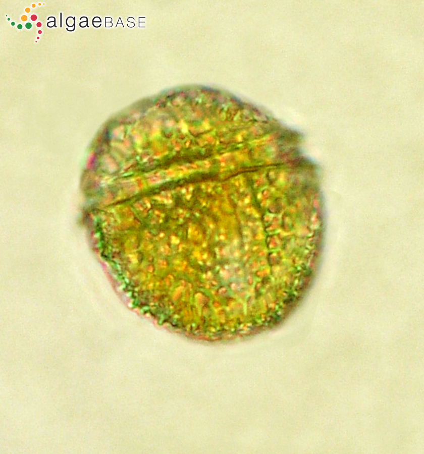 Protoceratium reticulatum (Claparède & Lachmann) Bütschli