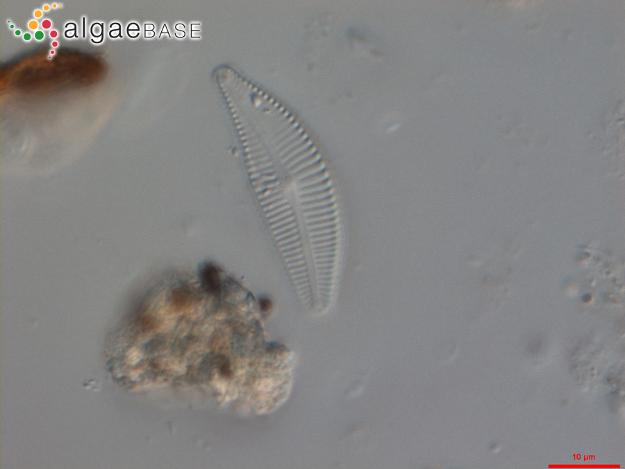 Cymbella subturgidula Krammer