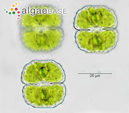 Cosmarium boeckii faceviews