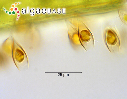 Epipyxis utriculus (Ehrenberg) Ehrenberg