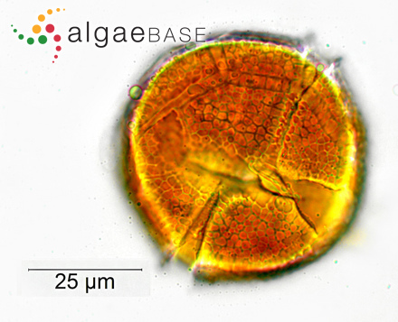 Peridinium cinctum (O.F.Müller) Ehrenberg