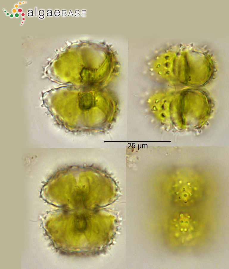 Staurastrum scabrum Brébisson