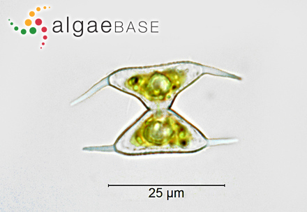 Staurodesmus glaber (Ralfs) Teiling