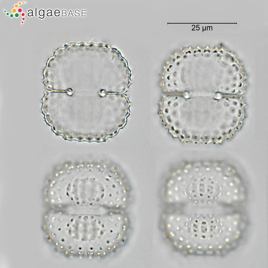 Cosmarium costatum Nordstedt