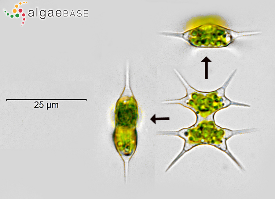 Staurodesmus octocornis (Ehrenberg ex Ralfs) Stastny, Skaloud & Neustupa