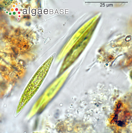 Elakatothrix gelatinosa Wille