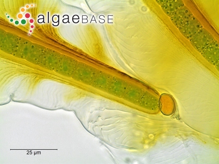 Lithothamnion fumigatum f. aucklandica Foslie