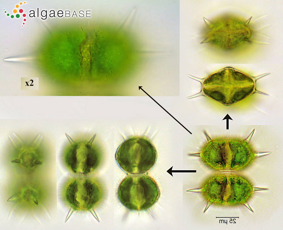 Xanthidium antilopaeum Kützing