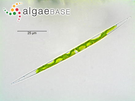 Closterium acutum Brébisson