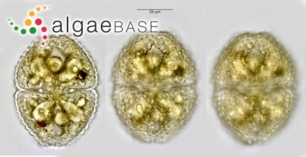 Cosmarium hornavanense var. dubovianum (Lütkemüller) Ruzicka