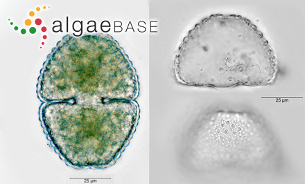 Cosmarium hornavanense var. dubovianum (Lütkemüller) Ruzicka