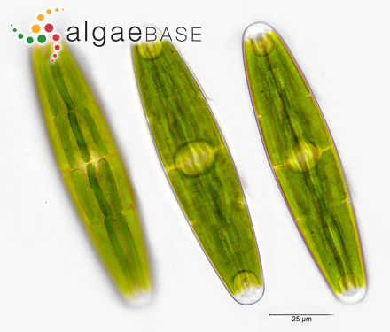 Closterium closterioides var. intermedium (J.Roy & Bisset) Ruzicka