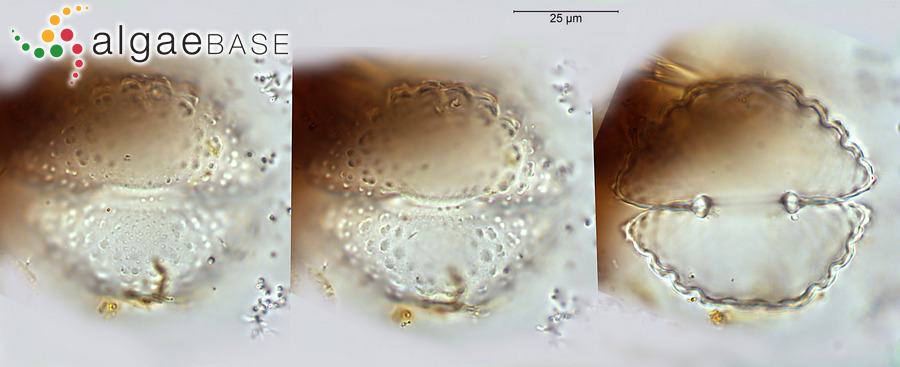 Cosmarium cyclicum var. arcticum (Nordstedt) Gutwinski