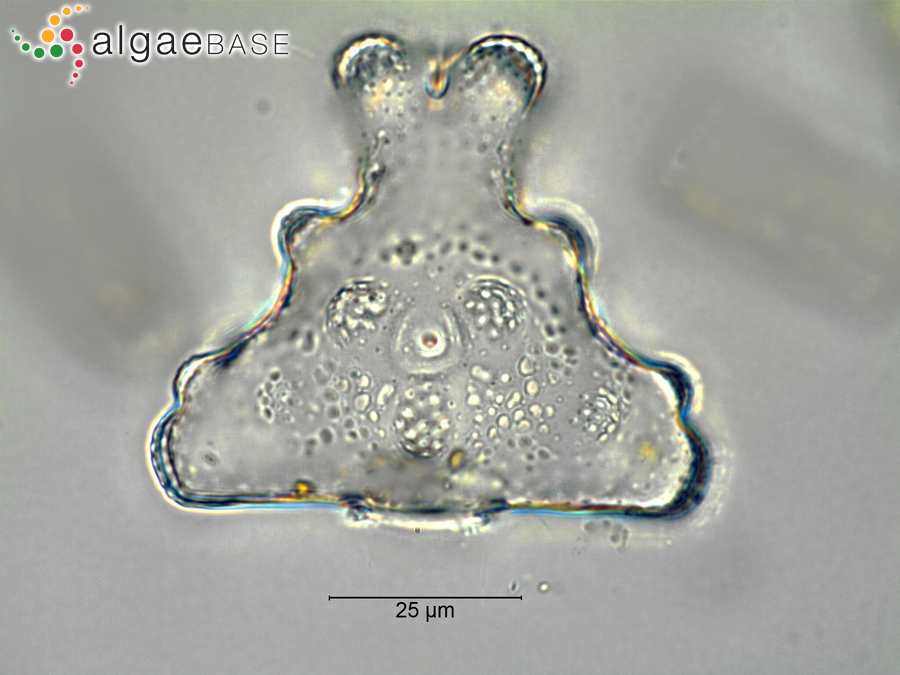 Euastrum humerosum var. affine (Ralfs) Raciborski