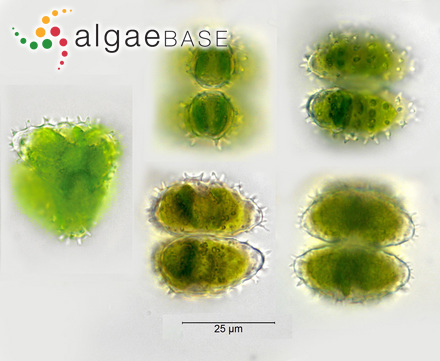 Staurastrum scabrum Brébisson