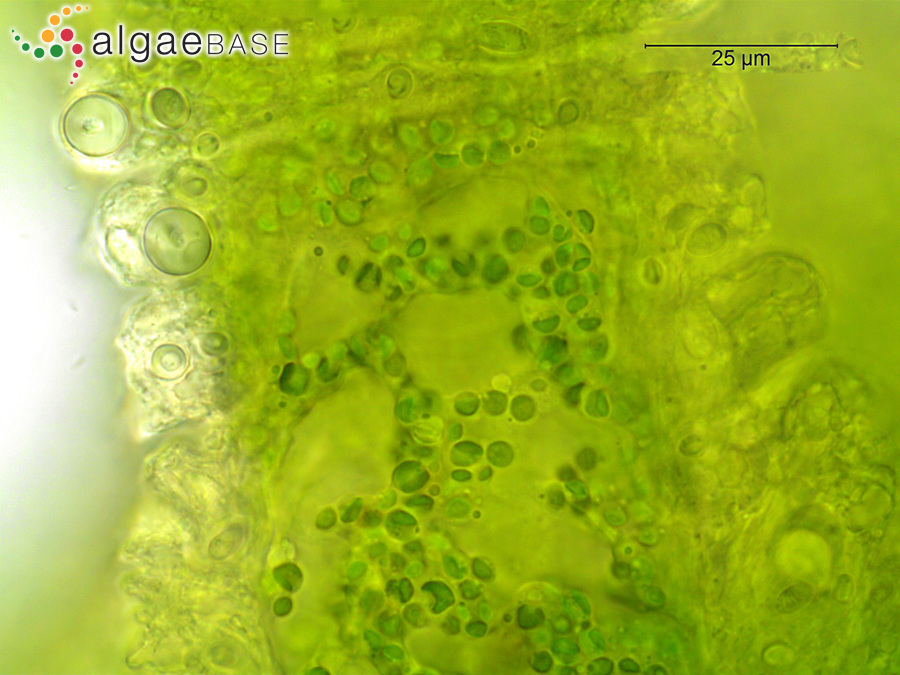 Choricystis parasitica (K.Brandt) Pröschold & Darienko