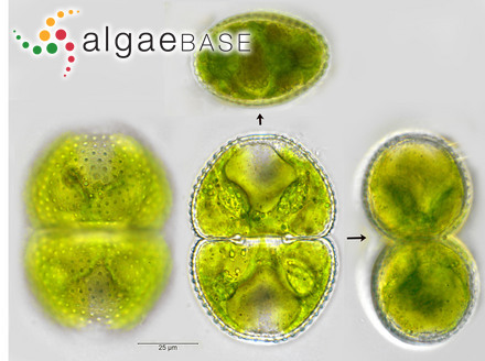 Cosmarium botrytis Meneghini ex Ralfs