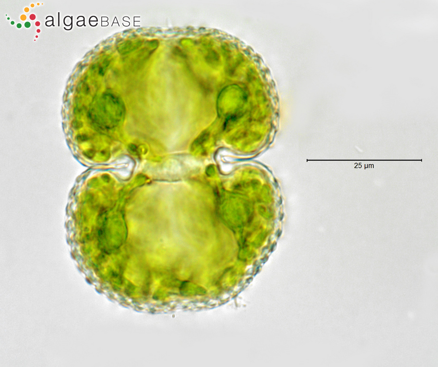 Cosmarium margaritatum var. subrotundatum (West & G.S.West) Petlovany