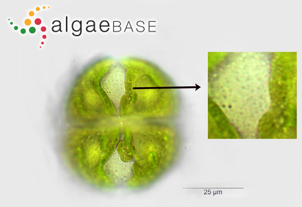 Cosmarium botrytis var. mediolaeve West