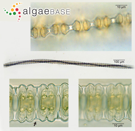 Desmidium aptogonum Brébisson ex Kützing