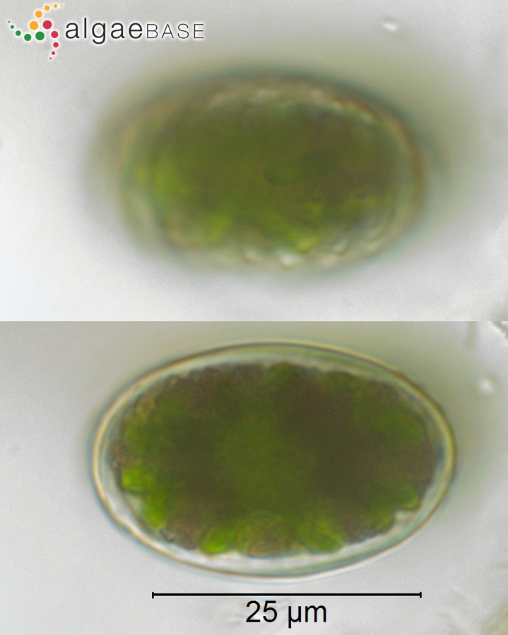 Cosmarium didymochondrum Nordstedt