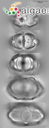 Euastrum ventricosum P.Lundell