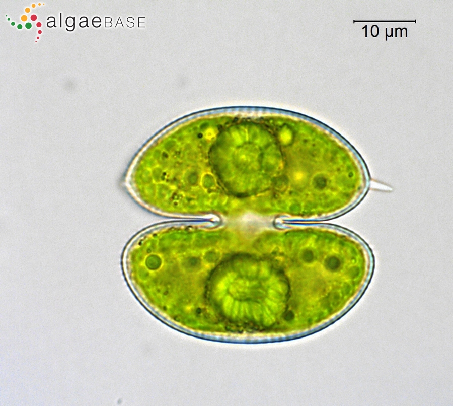 Staurodesmus convergens (Ehrenberg ex Ralfs) S.Lillieroth