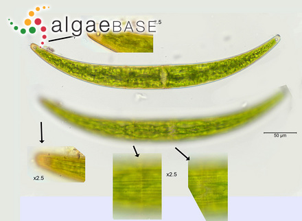 Closterium costatum var. borgei (Willi Krieger) Ruzicka