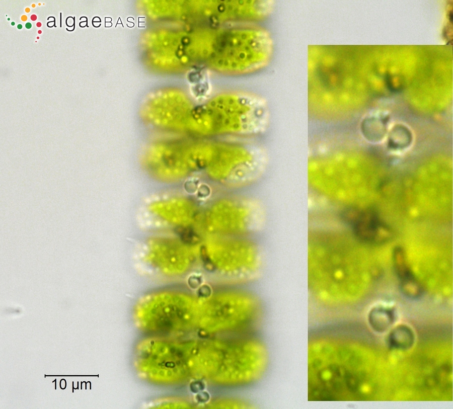 Sphaerozosma vertebratum Brébisson ex Ralfs