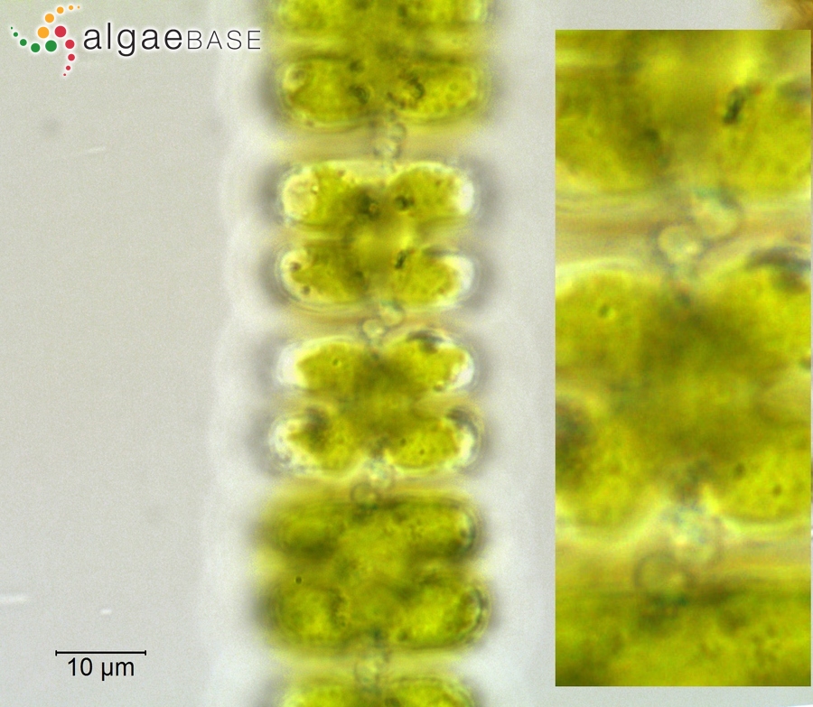 Sphaerozosma vertebratum Brébisson ex Ralfs