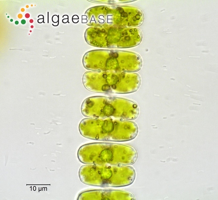 Sphaerozosma vertebratum Brébisson ex Ralfs