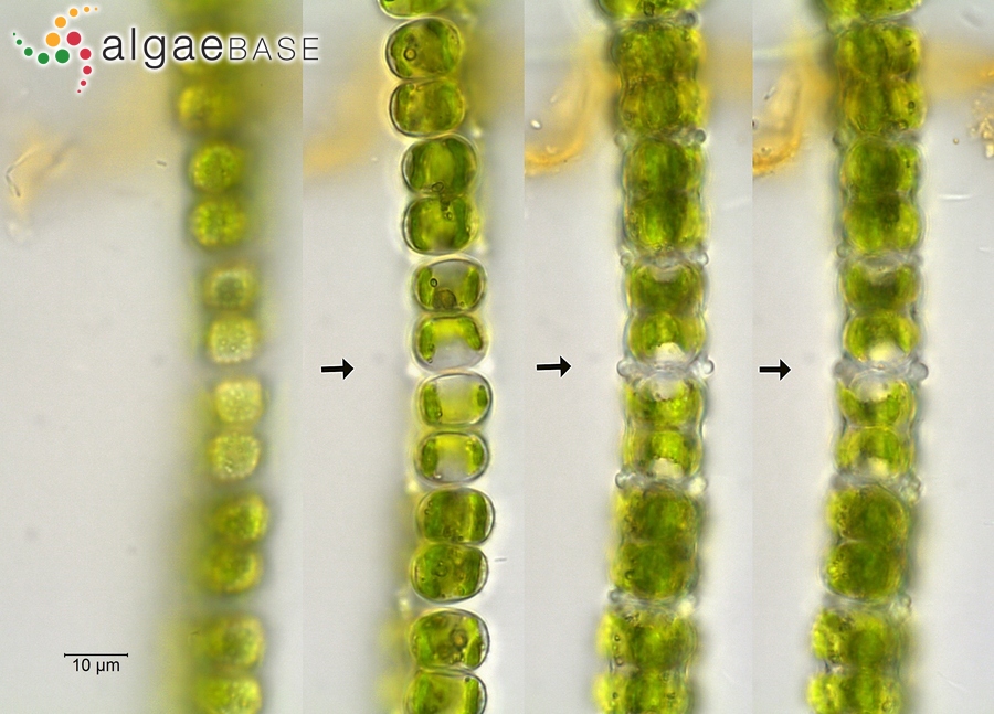 Sphaerozosma vertebratum Brébisson ex Ralfs