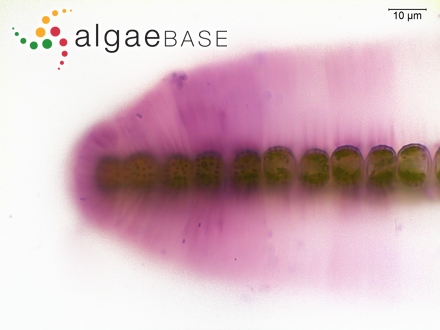 Sphaerozosma vertebratum Brébisson ex Ralfs