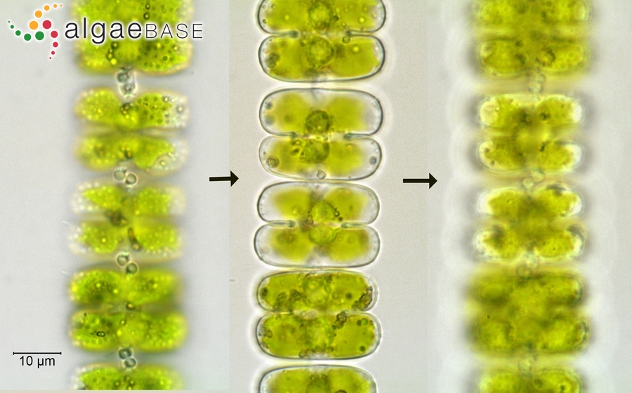 Sphaerozosma vertebratum Brébisson ex Ralfs